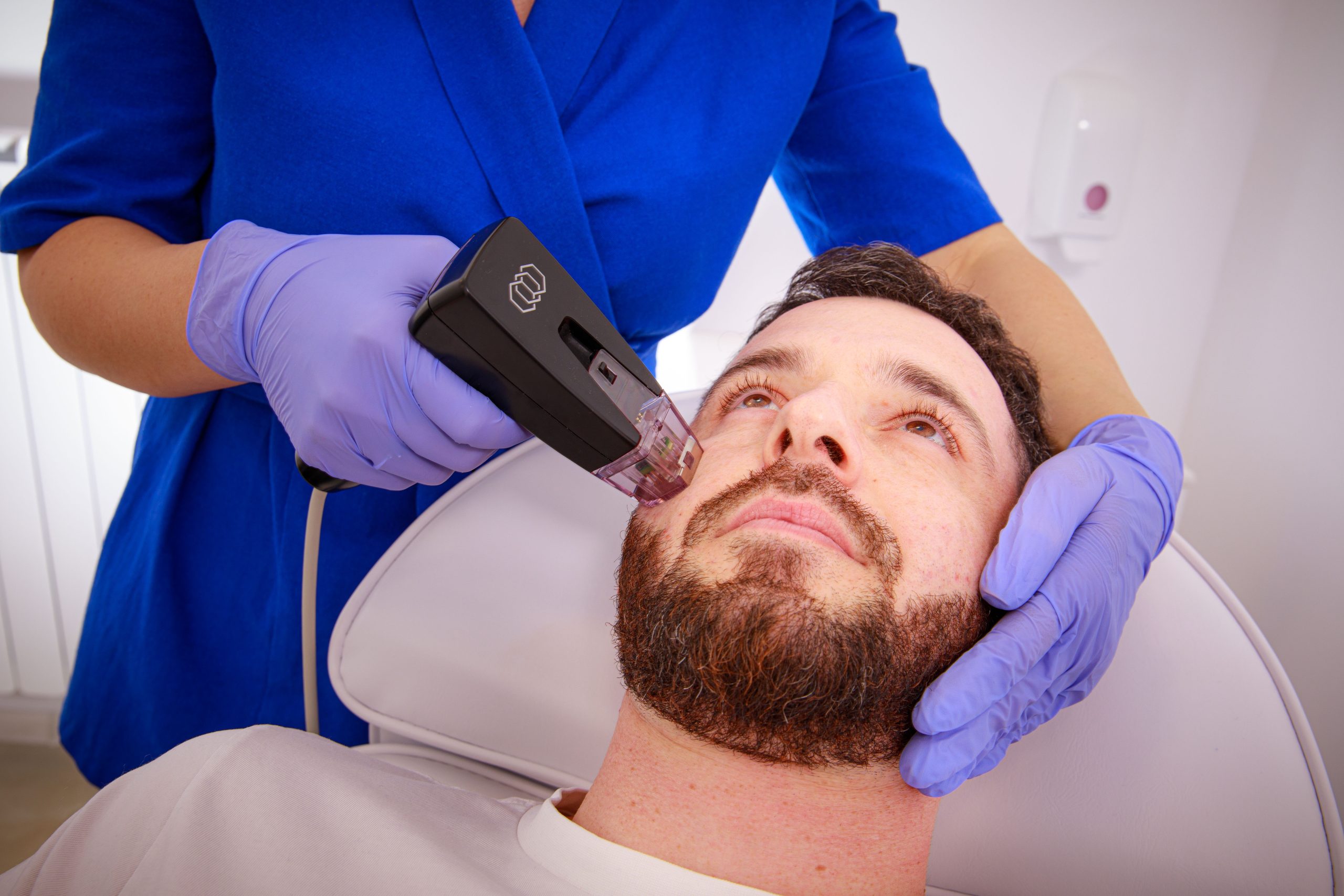 Esthetician giving Morpheus8 Laser hair removal treatment | Baltimore, MD