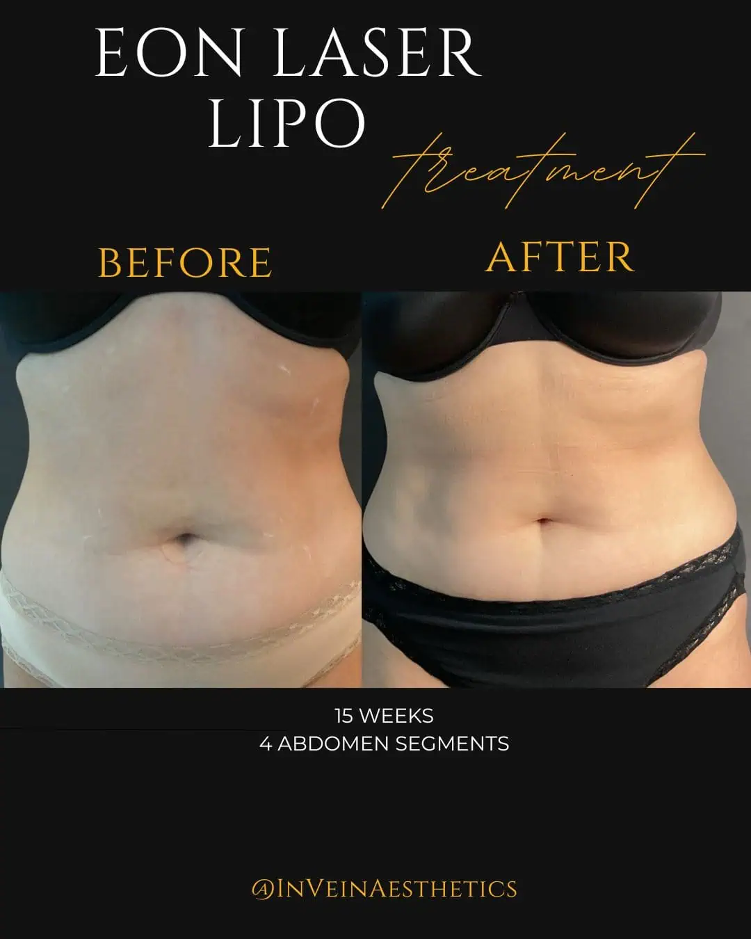 Katherine EON Before and After (Front profile) (1) 2