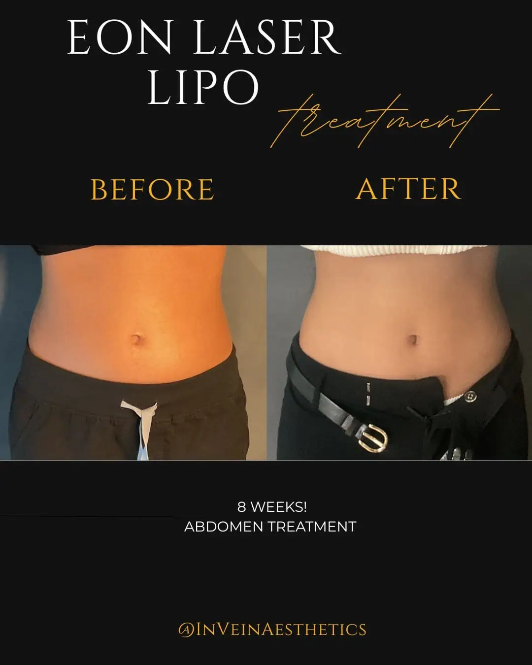 Zahra EON Before After