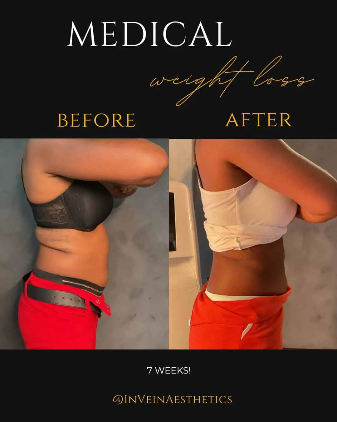 ashley before and after