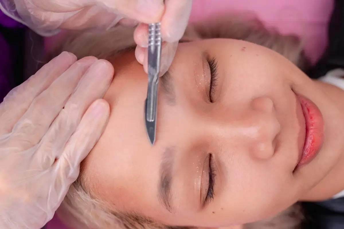 Professional dermaplaning treatment being performed on a patient in a clinical setting at InVein Aesthetics